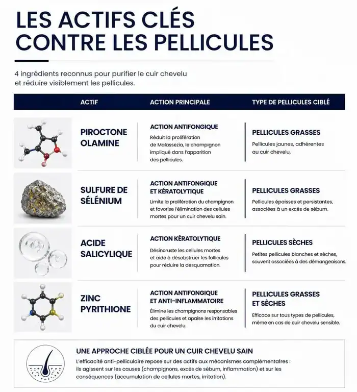 Infographie des meilleurs actifs pour shampoing anti pelliculaire selon le type de cuir chevelu